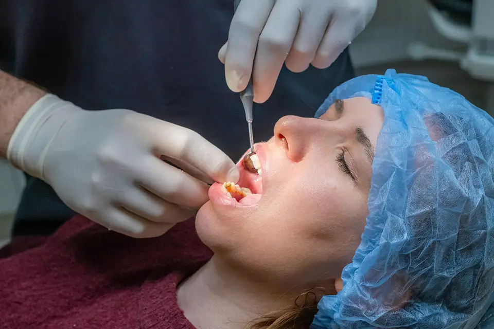Tooth Extraction Complications: What To Know and How to Prevent Them