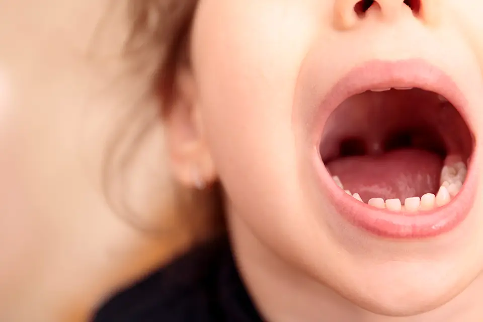 Normal Socket After Tooth Extraction: What's Normal, What's Not, and How to Heal Well