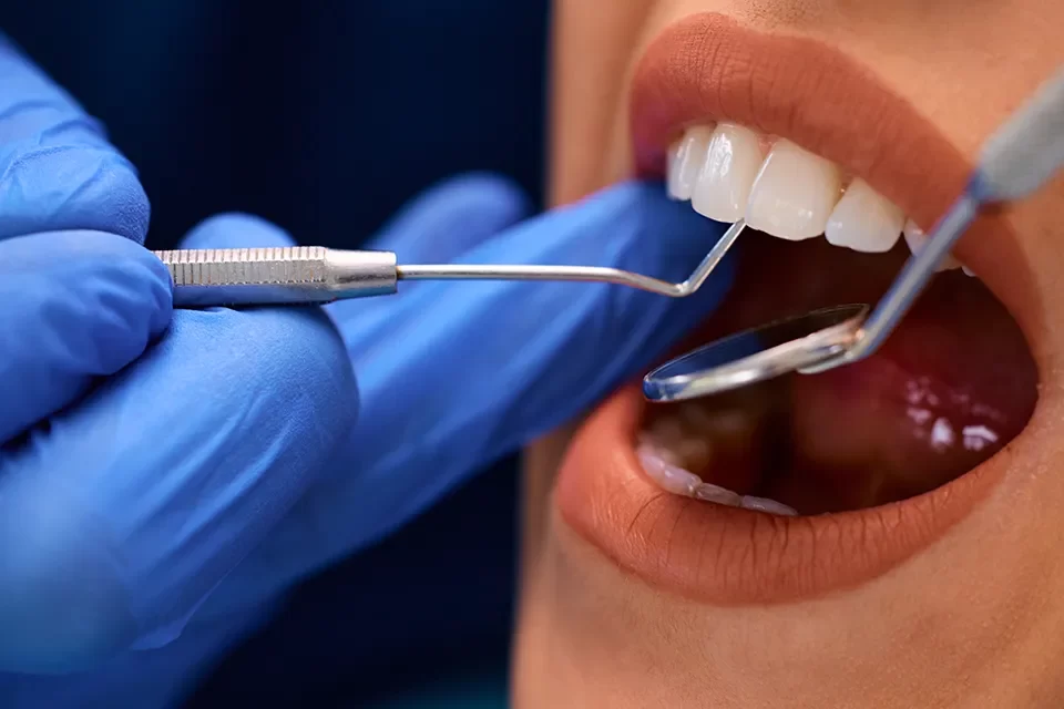 Canadian Dental Care Plan
