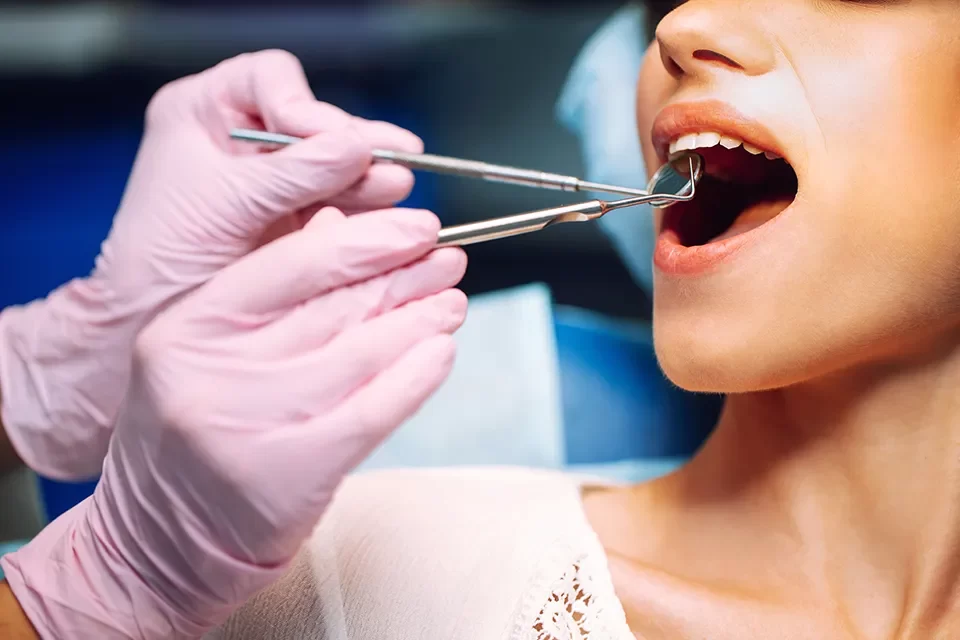 Dental Bridges