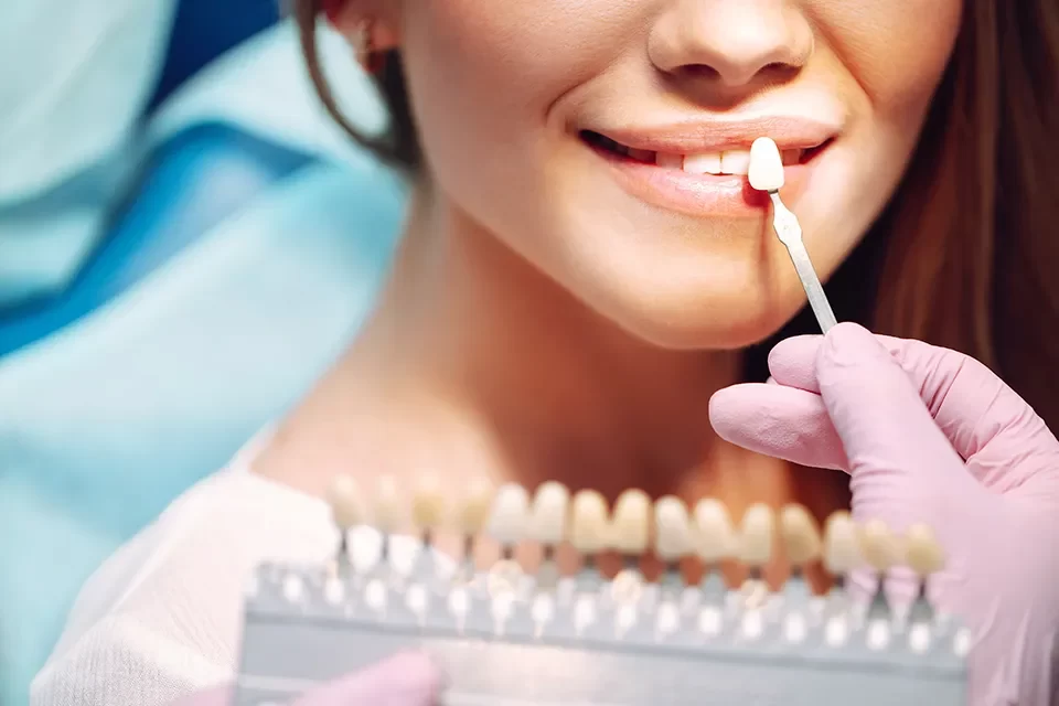 Dental Crowns