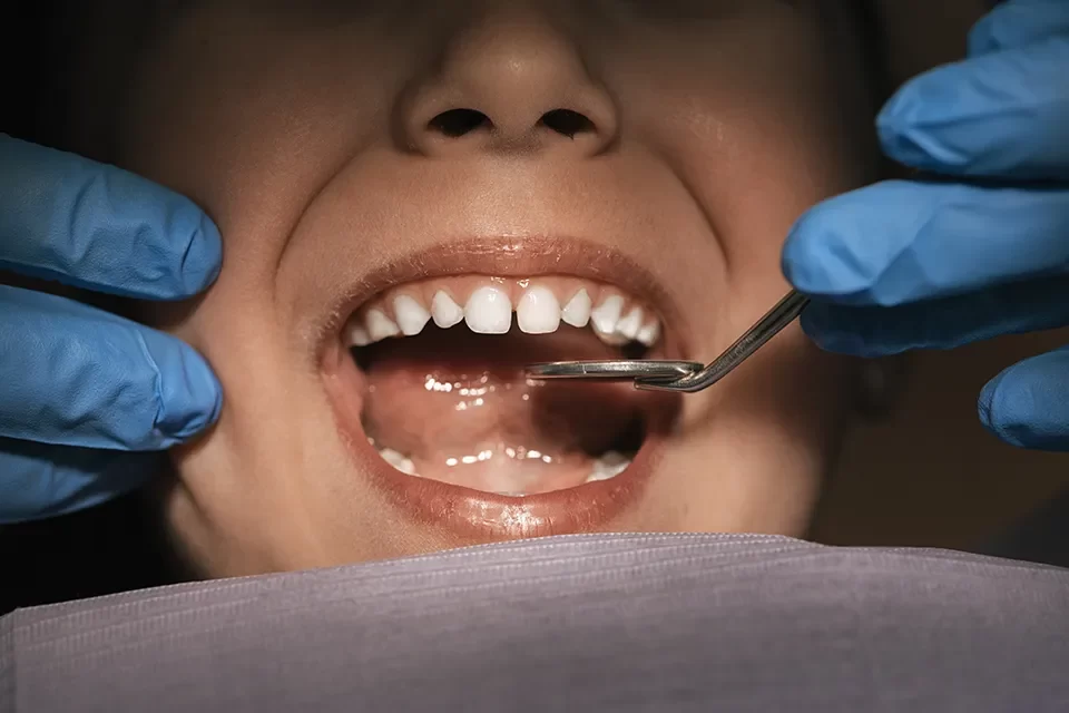 Dental Exams