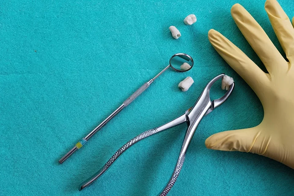Dental Extraction