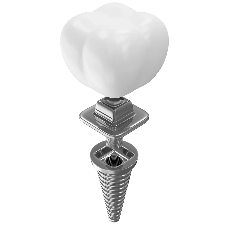 Dental Implants Dental Implants