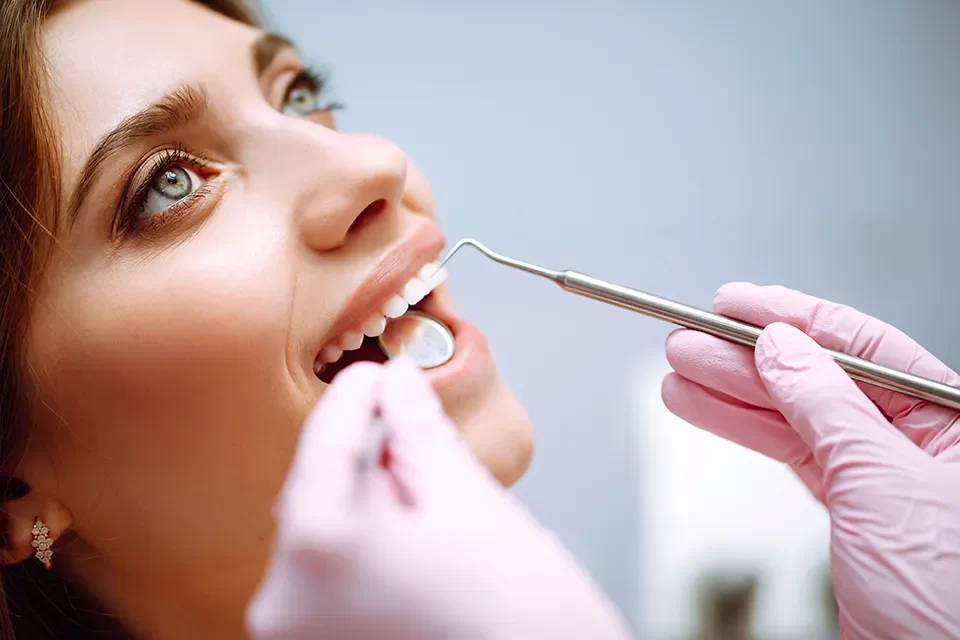 Dental Veneers