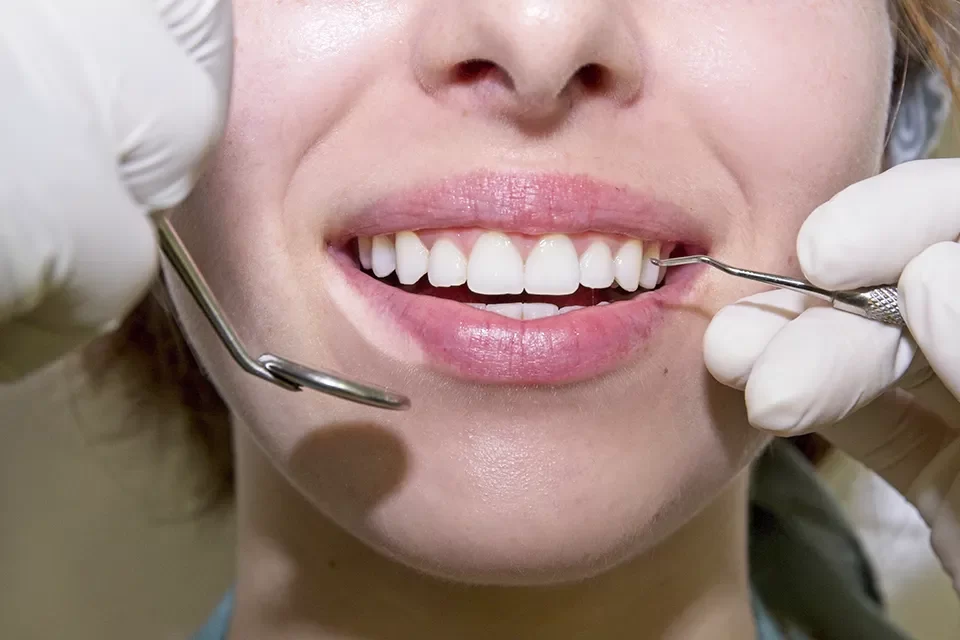 Dentist in Upper Beaches