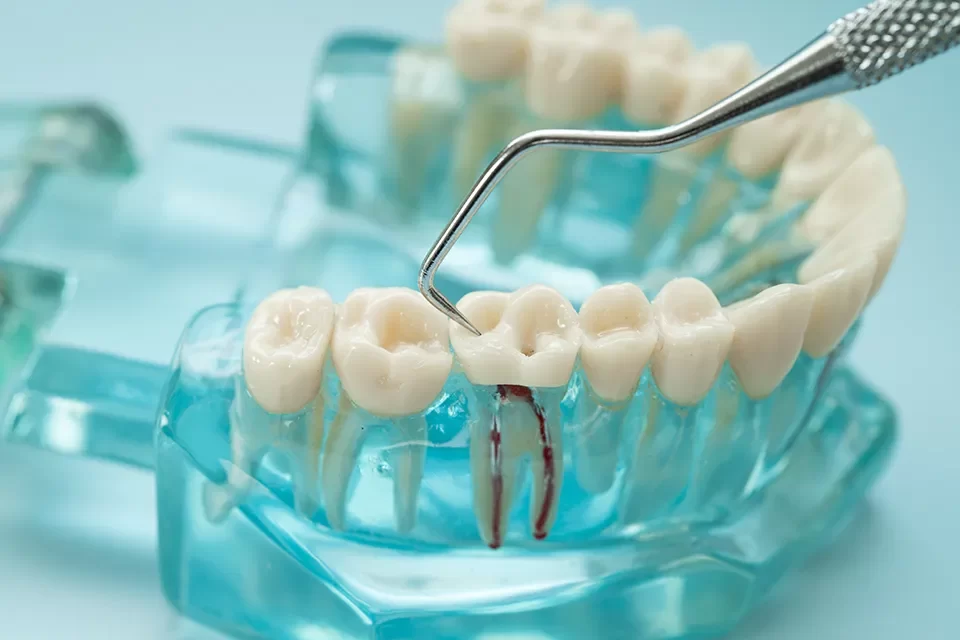 Endodontics