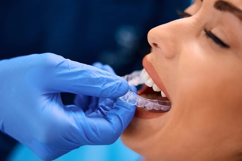Invisalign