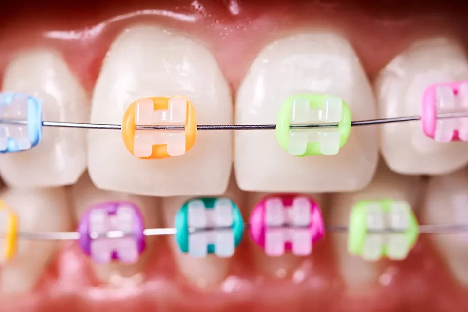 Orthodontics