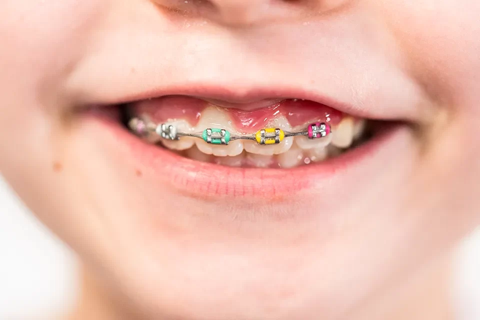 Orthodontics