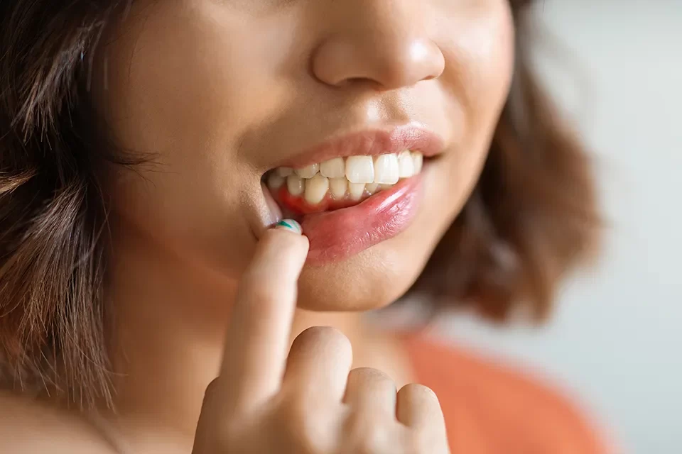 Periodontics