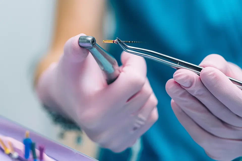 Root Canal Therapy