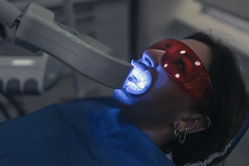 Teeth Whitening
