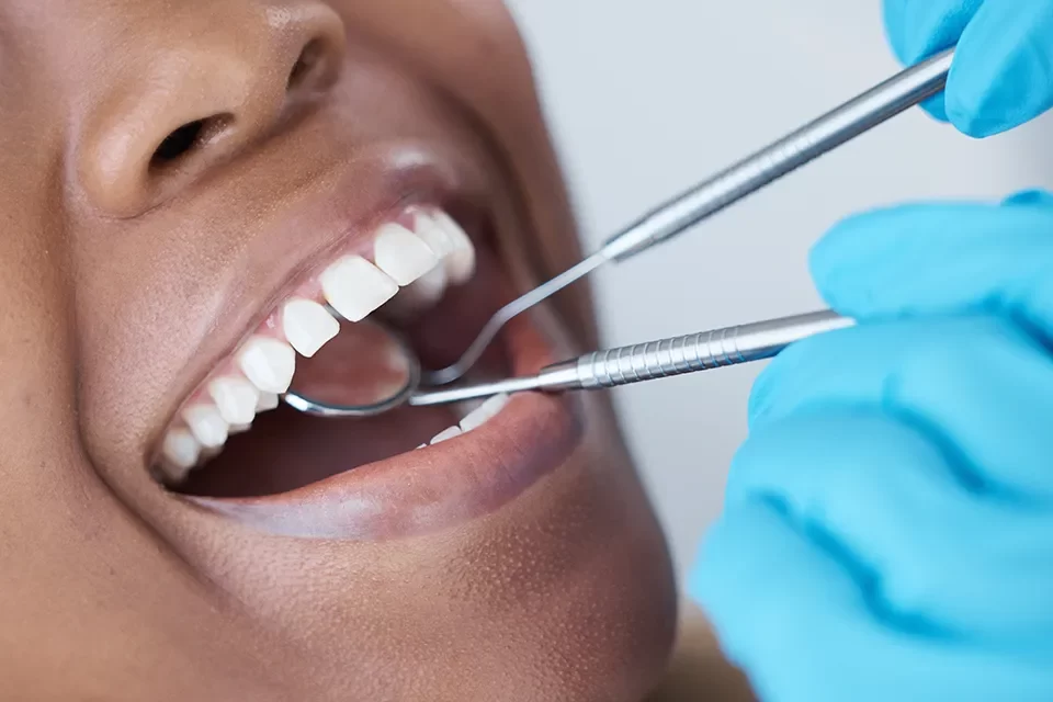 Teeth Whitening