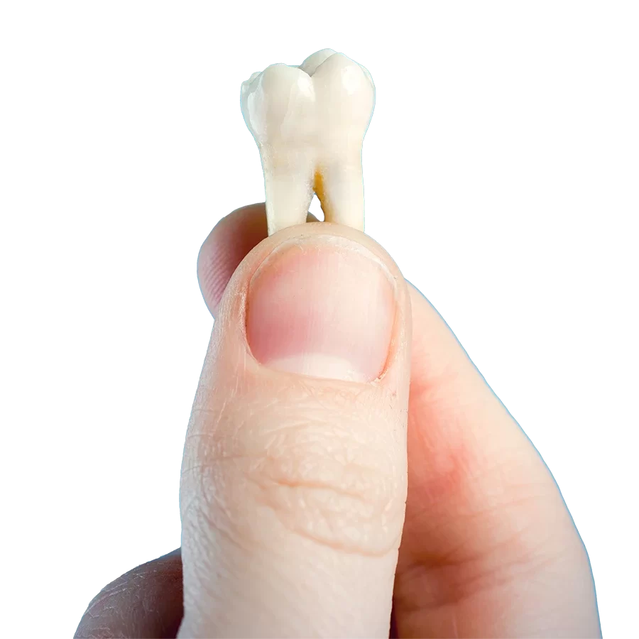 Wisdom Teeth Removal Leslieville